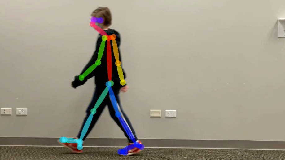 iGAIT: Gait Analysis and AI-Based Motion Understanding